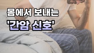 간암신호 복수 자가진단 [upl. by Sophia]