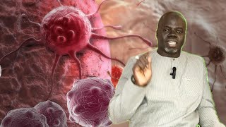 1  Le Cancer Symptômes et Causes  Pr Ousmane Ndiaye  SAMA XALAAT TV [upl. by Cameron448]