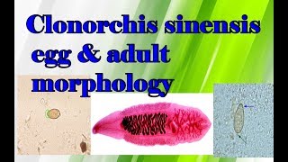 Clonorchis sinensis egg and adult morphology clear explanation [upl. by Anitsugua971]