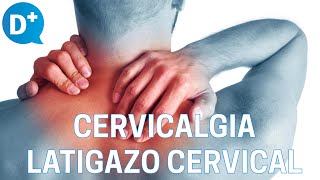 Causas y tratamiento de la cervicalgia y del latigazo cervical [upl. by Mosora]