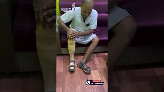 BELOW KNEE PROSTHESIS WITH ASPIRE LINER OSSUR AND BREEZE FOOT OSSUR [upl. by Indyc]