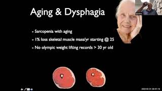 Dysphagia amp Transnasal Esophagoscopy I  Dr Gregory Postma [upl. by Adrial862]