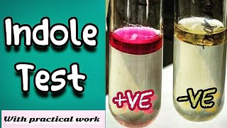 Indole test  Microbiology Microbial Biochemical test [upl. by Hurlbut]