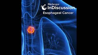 Emerging Biomarkers and Novel Therapies for Esophageal Cancer [upl. by Lolita26]