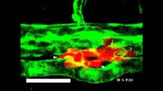 Efficient extravasation of tumorrepopulating cells depends on cell deformability [upl. by Nylirek]