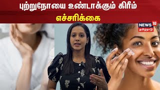 புற்றுநோயை உண்டாக்கும் கிரீம்  எச்சரிக்கை  Lifestyle  Health  Cancer  N18V [upl. by Ijnek375]