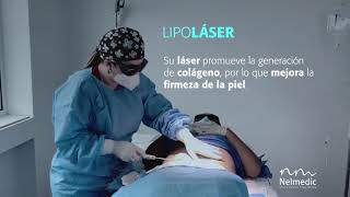 Conoce más de la LipoLaser [upl. by Kerman]