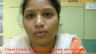 Lichen Planus treated by Dr Rajesh Shah at Life Force [upl. by Rhett331]