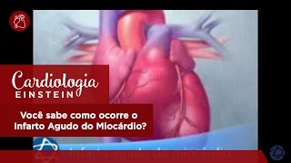 Você sabe como ocorre o Infarto Agudo do Miocárdio [upl. by Evonne]