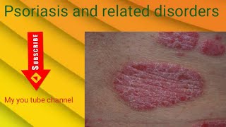 Skin disease psoriasis and related disorders [upl. by Pan1]