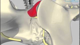 Lumbosacral distraction stabilisation surgical technique developed by Noel Fitzpatrick [upl. by Sybila]