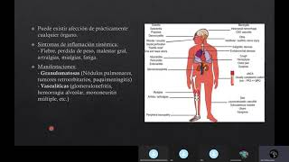 Granulomatosis con Poliangeitis [upl. by Ainala]