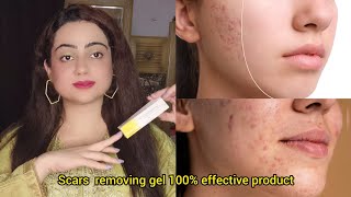 Acne scars removal Gel  contractubex Gel beauty facts acnescars scars pimples [upl. by Volnak264]