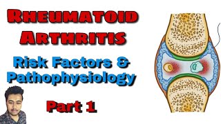 Rheumatoid Arthritis Types of Arthritis  Pathology  Treatment Nursing Lecture in Hindi Part 1 [upl. by Neliac17]