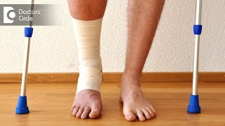 How to heal a broken bone faster  Dr Hanume Gowda [upl. by Akemet]