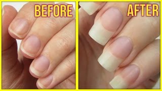 5 Ways to Grow Your Nails FAST [upl. by Irrac]