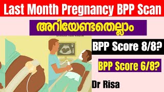 9 month Pregnancy ScanLast Month Pregnancy ScanWhat is BPP score [upl. by Bil604]