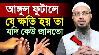 হাতপায়ের আঙ্গুল ফুটালে যে ক্ষতি হয় অনেকে তা জানেই না  Shaikh Ahmadullah  শায়খ আহমাদুল্লাহ [upl. by Aseeral]