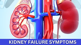 KIDNEY FAILURE Symptoms You Need to Know RIGHT NOW [upl. by Holton]