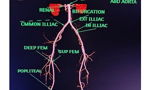 CT Lower Limb Angiography Anatomy CT scanPost processing avnishradiologypart1 [upl. by Eustazio]