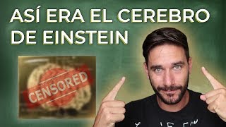 ¿Qué tiene el cerebro de Einstein que no tenga el tuyo [upl. by Neelyhtak]