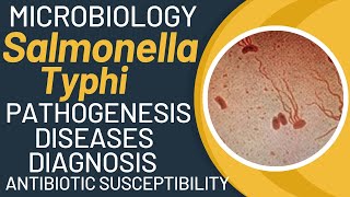 Salmonella typhi microbiology  Typhoid fever pathogenesis by salmonella typhimurium [upl. by Woehick]