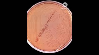 Bowel nosode series Bacillus proteus skarthiyaini karthiyaini sekarTrichytamilnadu India [upl. by Alemrac]