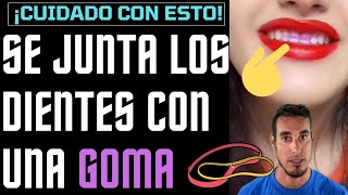 Se corrige con GOMAS su DIASTEMA o ESPACIO entre DIENTES ella sola  ¡Cuidado [upl. by Doyle243]