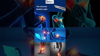 TenJet  a minimally invasive treatment option for chronic tendon pain [upl. by Ehcram777]