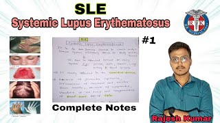 systemic Lupus Erythematosus SLEin hindi INTEGUMENTARY PROBLEMS bscnursing and GNMrknursingpoint [upl. by Dub]