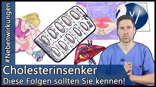 Nehmen Sie Cholesterinsenker Achten Sie auf diese Gefahren amp Nebenwirkungen [upl. by Klemm361]