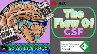 The Flow of CSF and Pathologies [upl. by Noivart]