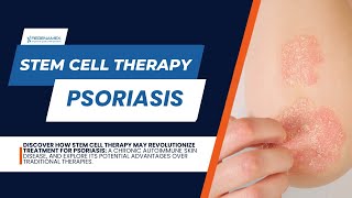 Psoriasis Sufferers Rejoice Stem Cell Therapy is Changing the Game [upl. by Alaehs]