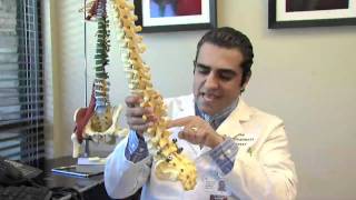 Spine Treatment Center  X Stop Surgical Procedure [upl. by Wendy]