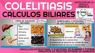 CÁLCULOS BILIARES FISIOPATOLOGÍA PARTE 2  GuiaMed [upl. by Topliffe69]