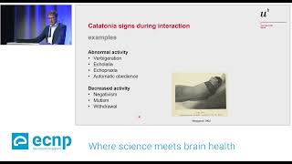 Catatonia aetiology presentation assessment and treatment 2392024 [upl. by Eudora]