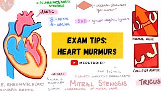 How to remember heart murmurs  Mnemonics Diagrams amp More  MedStudier [upl. by Mcnalley]