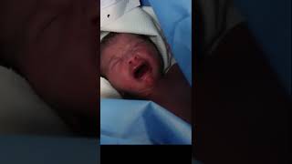 Is it normal for My newborn baby to cry with tears 😢😍🍼 bornebaby cutebabyboy viral crybaby [upl. by Annil]