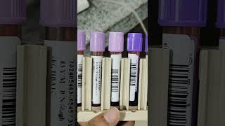 HbA1C Test Hematology Lab resultD 10 [upl. by Brenza861]