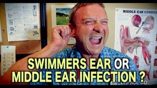 Is it Swimmers Ear or Middle Ear Infection  Pediatric Advice [upl. by Ayn]