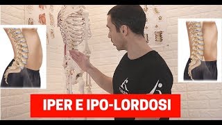 Migliorare la POSTURA DELLA SCHIENA esercizi per IPO e IPER LORDOSI lombare [upl. by Grati]