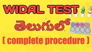 Widal test in telugu👌compete procedure [upl. by Jacquelynn]