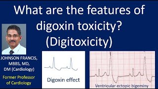 What are the features of digoxin toxicity Digitoxicity [upl. by Rutan]