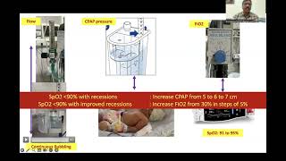 Non invasive ventilation in neonate by Dr Srinivas Murki [upl. by Zuleika]