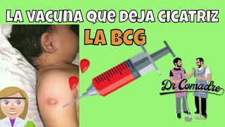 La vacuna BCG 💉 ¿funciona ¿Cómo saber si la tengo [upl. by Persas]