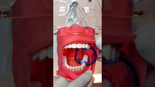 Afastador de língua e bochecha dentist odontologia tips [upl. by Reinke]