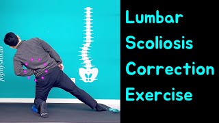 Lumbar Scoliosis Schroth Method Exercise Scoliosis Correction Single Curved Spine [upl. by Arlo]