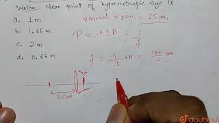 A person uses a lens of power 3D to normalise vision Near point of hypermetropic eye is [upl. by Coffeng937]