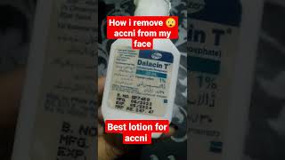 Best medicated cream remove accni dark spots Dalacin t lotion review shortsviral [upl. by Eanert]