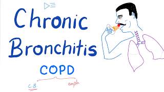 Chronic Bronchitis  COPD  Pulmonology Lectures [upl. by Adelpho196]